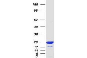 Western Blotting (WB) image for Glutathione S-Transferase alpha 1 (GSTA1) protein (Myc-DYKDDDDK Tag) (ABIN2722268)