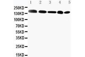 Anti-Gli2 antibody, Western blotting Lane 1: MCF-7 Cell Lysate Lane 2: HELA Cell Lysate Lane 3: SKOV Cell Lysate Lane 4:  Cell Lysate Lane 5: A549 Cell Lysate (GLI2 antibody  (C-Term))