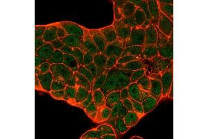 Immunofluorescence Analysis of PFA-fixed MCF-7 cells.