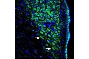 Expression of ASIC channels in rat locus coeruleus - Immunohistochemical staining of perfusion-fixed rat brain frozen sections using Anti-pan ASIC (extracellular) Antibody (ABIN7042913, ABIN7045258 and ABIN7045259), (1:400), followed by goat-anti-rabbit-AlexaFluor-488. (ASIC1 antibody  (Extracellular Loop))