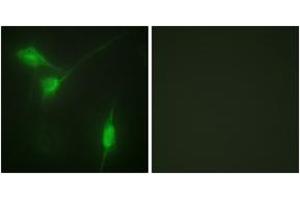 Immunofluorescence analysis of NIH-3T3 cells, using Akt (Phospho-Ser246) Antibody. (AKT1 antibody  (pSer246))