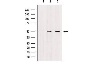Western blot analysis of extracts from various samples, using Annexin VII antibody.