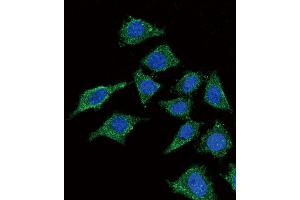 Confocal immunofluorescent analysis of LCAT Antibody (Center) (ABIN653825 and ABIN2843093) with 293 cell followed by Alexa Fluor? (LCAT antibody  (AA 285-313))