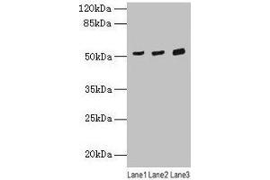 Western blot All lanes: CDR2 antibody at 4 μg/mL Lane 1: Mouse lung tissue Lane 2: Hela whole cell lysate Lane 3: HepG2 whole cell lysate Secondary Goat polyclonal to rabbit IgG at 1/10000 dilution Predicted band size: 52 kDa Observed band size: 52 kDa (CDR2 antibody  (AA 1-454))