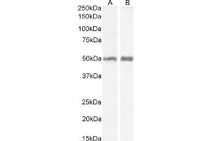 (ABIN768565) (0. (HRH2 antibody  (AA 309-323))