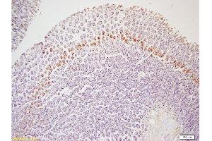 Immunohistochemistry (Paraffin-embedded Sections) (IHC (p)) image for anti-Leptin Receptor (LEPR) (AA 901-1000) antibody (ABIN725060)