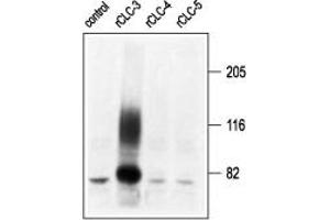 Western blot analysis of membranes from Xenopus oocytes, expressing CLC-3, CLC-4, and CLC-5, using Anti-CLC-3 (CLCN3) Antibody (ABIN7043052, ABIN7044121 and ABIN7044122) (kindly provided by Prof. (CLCN3 antibody  (C-Term, Intracellular))