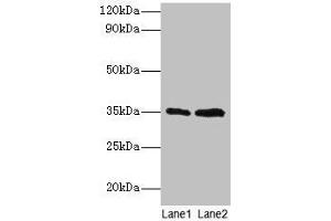 Western blot All lanes: GTF2B antibody at 2 μg/mL Lane 1: HepG2 whole cell lysate Lane 2: Hela whole cell lysate Secondary Goat polyclonal to rabbit IgG at 1/15000 dilution Predicted band size: 35 kDa Observed band size: 35 kDa (GTF2B antibody  (AA 1-316))
