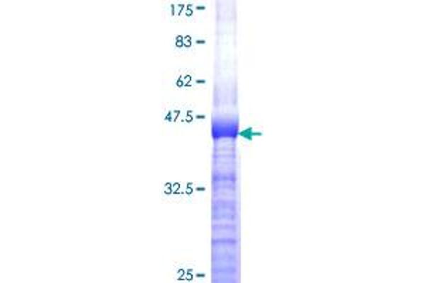 IRS4 Protein (AA 850-950) (GST tag)