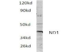 Image no. 1 for anti-Mitochondrially Encoded NADH Dehydrogenase 1 (MT-ND1) antibody (ABIN317922) (MT-ND1 antibody)