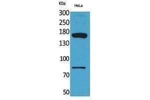 Western Blotting (WB) image for anti-CD163 Molecule-Like 1 (CD163L1) (Internal Region) antibody (ABIN3187909) (CD163L1 antibody  (Internal Region))