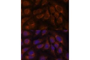 Immunofluorescence analysis of U-2 OS cells using CREB3 antibody (ABIN6128862, ABIN6139013, ABIN6139015 and ABIN6222241) at dilution of 1:100. (CREB3 antibody  (AA 1-230))