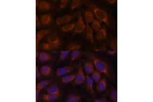 Immunofluorescence analysis of U-2 OS cells using CREB3 antibody (ABIN6128862, ABIN6139013, ABIN6139015 and ABIN6222241) at dilution of 1:100. (CREB3 antibody  (AA 1-230))