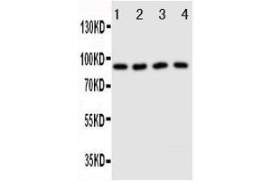 Anti-Cullin3 antibody, Western blotting Lane 1: HELA Cell Lysate Lane 2: MCF-7 Cell Lysate Lane 3: Rat Testis Tissue Lysate Lane 4: Rat Brain Tissue Lysate (Cullin 3 antibody  (Middle Region))
