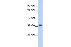 WB Suggested Anti-HIBADH Antibody Titration: 0. (HIBADH antibody  (Middle Region))
