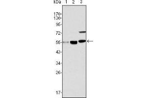 Western blot analysis using MYST1 mouse mAb against Hela (1), HepG2 (2) and SMMC-7721 (3) cell lysate.