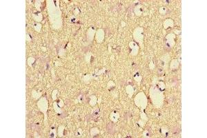 Immunohistochemistry of paraffin-embedded human brain tissue using ABIN7161278 at dilution of 1:100 (NEFL antibody  (AA 128-271))
