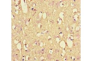 Immunohistochemistry of paraffin-embedded human brain tissue using ABIN7161278 at dilution of 1:100 (NEFL antibody  (AA 128-271))