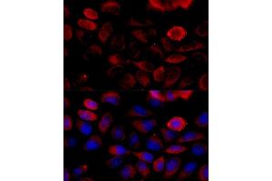 Immunofluorescence analysis of HeLa cells using FGFR2 antibody (ABIN6130457, ABIN6140615, ABIN6140617 and ABIN6216059) at dilution of 1:100 (40x lens). (FGFR2 antibody  (AA 245-345))