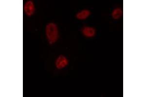 ABIN6272423 staining HepG2 by IF/ICC. (Retinoid X Receptor gamma antibody  (Internal Region))