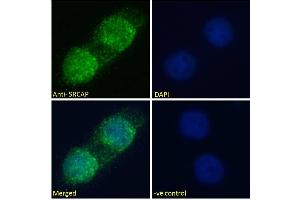 SRCAP antibody  (Internal Region)