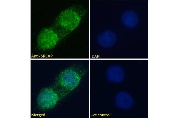 SRCAP antibody  (Internal Region)