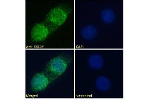 ABIN570790 Immunofluorescence analysis of paraformaldehyde fixed A431 cells, permeabilized with 0. (SRCAP antibody  (Internal Region))