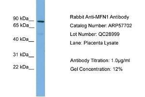 WB Suggested Anti-MFN1  Antibody Titration: 0. (MFN1 antibody  (Middle Region))