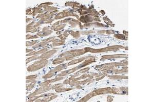 Immunohistochemical staining of human heart muscle with HHATL polyclonal antibody  shows moderate cytoplasmic positivity in myocytes at 1:10-1:20 dilution.