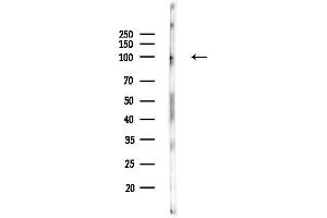 anti-Ligase IV, DNA, ATP-Dependent (LIG4) (C-Term) antibody