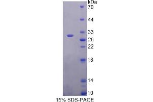 Image no. 1 for Inhibitory Subunit of NF kappa B delta (IkBd) (AA 58-304) protein (His tag) (ABIN6238071) (IkBd Protein (AA 58-304) (His tag))