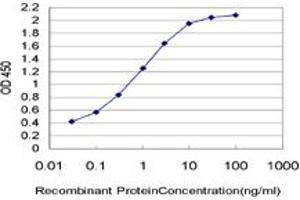 Detection limit for recombinant GST tagged UPK1B is approximately 0. (Uroplakin 1B antibody  (AA 131-228))