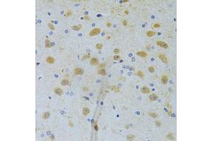 Immunohistochemistry of paraffin-embedded rat brain using CHIA Antibody (ABIN5973937) at dilution of 1/100 (40x lens). (CHIA antibody)