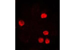 Immunofluorescent analysis of PCNA staining in HeLa cells. (PCNA antibody  (Center))