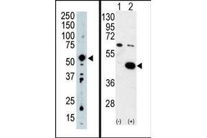 (LEFT) Western blot analysis of PDK2 Antibody (C-term) in mouse intestine tissue lysate (35ug/lane). (PDK2 antibody  (C-Term))