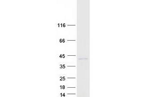 Western Blotting (WB) image for Renalase, FAD-Dependent Amine Oxidase (RNLS) (Transcript Variant 1) protein (Myc-DYKDDDDK Tag) (ABIN2730711)
