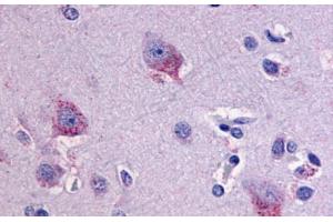 Latrophilin 1 antibody  (C-Term)