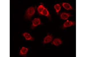ABIN6274153 staining Hela by IF/ICC. (HEXB antibody  (C-Term))