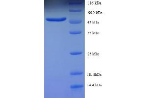 SDS-PAGE (SDS) image for SWI/SNF Related, Matrix Associated, Actin Dependent Regulator of Chromatin, Subfamily B, Member 1 (SMARCB1) (AA 2-376), (partial) protein (His tag) (ABIN4986570)