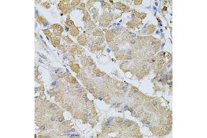 Immunohistochemistry of paraffin-embedded human stomach using BEST1 antibody. (Bestrophin 1 antibody  (AA 200-300))