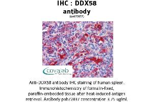 Image no. 3 for anti-DEAD (Asp-Glu-Ala-Asp) Box Polypeptide 58 (DDX58) antibody (ABIN1733572) (DDX58 antibody)
