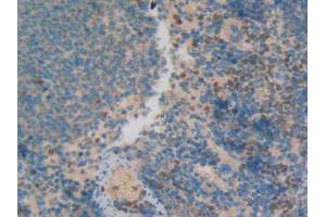 IHC-P analysis of Rat Spleen Tissue, with DAB staining. (MRP1 antibody  (AA 21-115))