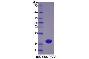 SDS-PAGE (SDS) image for Otoraplin (OTOR) (AA 17-121) protein (His tag) (ABIN4989469)