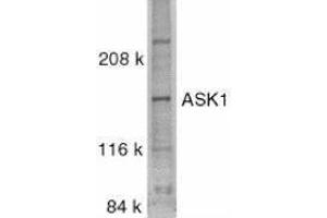 Western Blotting (WB) image for anti-Mitogen-Activated Protein Kinase Kinase Kinase 5 (MAP3K5) (C-Term) antibody (ABIN2477505) (ASK1 antibody  (C-Term))