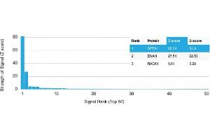 Analysis of Protein Array containing more than 19,000 full-length human proteins using Spectrin, alpha 1 Mouse Monoclonal Antibody (SPTA1/1810) Z- and S- Score: The Z-score represents the strength of a signal that a monoclonal antibody (MAb) (in combination with a fluorescently-tagged anti-IgG secondary antibody) produces when binding to a particular protein on the HuProtTM array. (SPTA1 antibody  (AA 356-475))