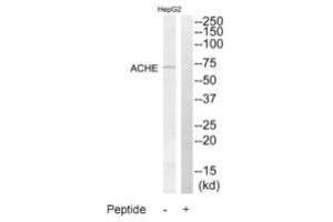 Western blot analysis of extracts from HepG2 cells, using ACHE antibody. (Acetylcholinesterase antibody  (C-Term))