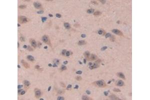 Figure. (Neuromedin B antibody  (AA 8-114))