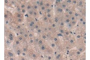 Detection of Sp100 in Human Liver Tissue using Polyclonal Antibody to Sp100 Nuclear Antigen (Sp100) (SP100 antibody  (AA 610-802))