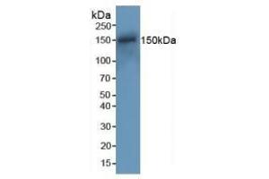 Detection of RAD50 in Mouse Spleen Tissue using Polyclonal Antibody to DNA Repair Protein RAD50 (RAD50) (RAD50 antibody  (AA 1-234))