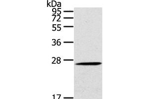 Western Blot analysis of Mouse liver tissue using CLEC4A Polyclonal Antibody at dilution of 1:100 (CLEC4A antibody)